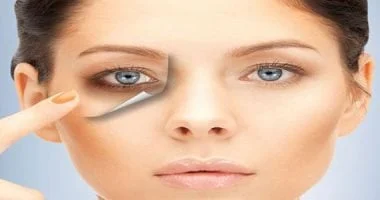 وصفات طبيعية للتخلص من الهالات السوداء تحت العين بدون كونسيلر