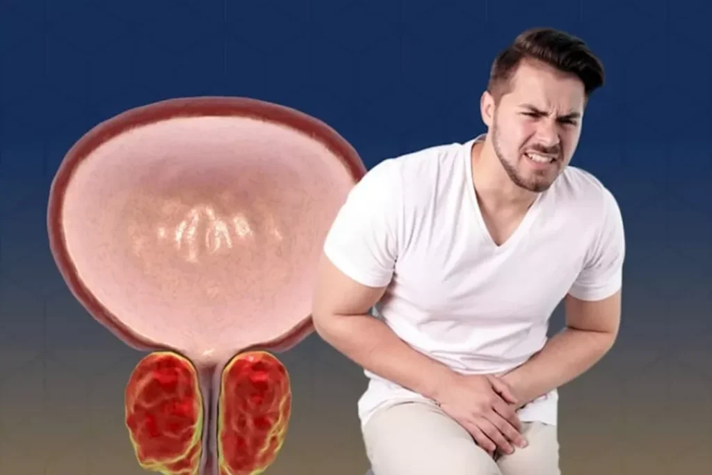 هل احتقان البروستاتا يسبب الالتهابات؟