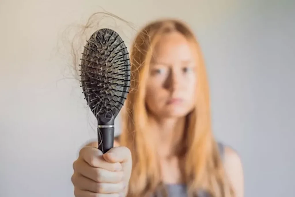 أمراض تسبب تساقط الشعر: 7 مشاكل غير الصلع