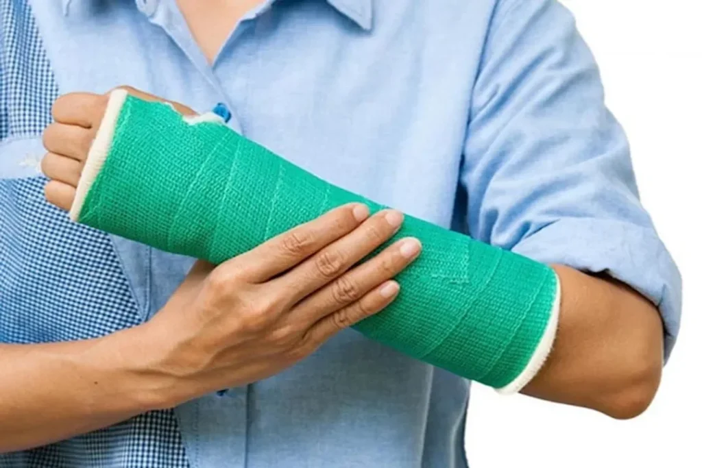 الإسعافات الأولية لكسور العظام