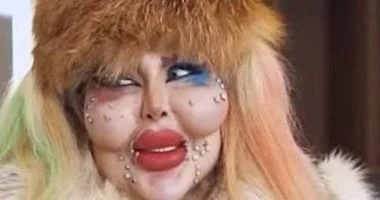 انفلونسر تثير الجدل بعد 388 عمليات تجميل وتقول الجوهر أهم من الشكل