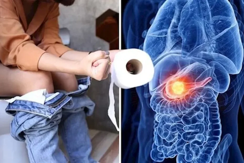 4 أعراض تظهر على المصاب بسرطان البنكرياس