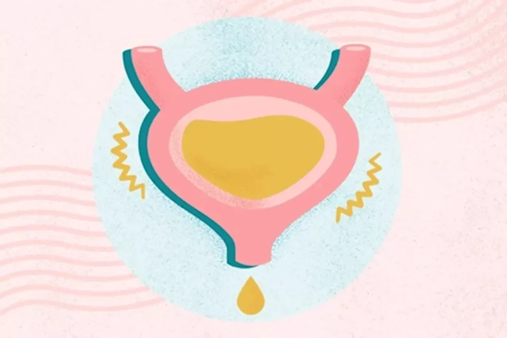 علاج تسرب البول: 9 طرق مجربة