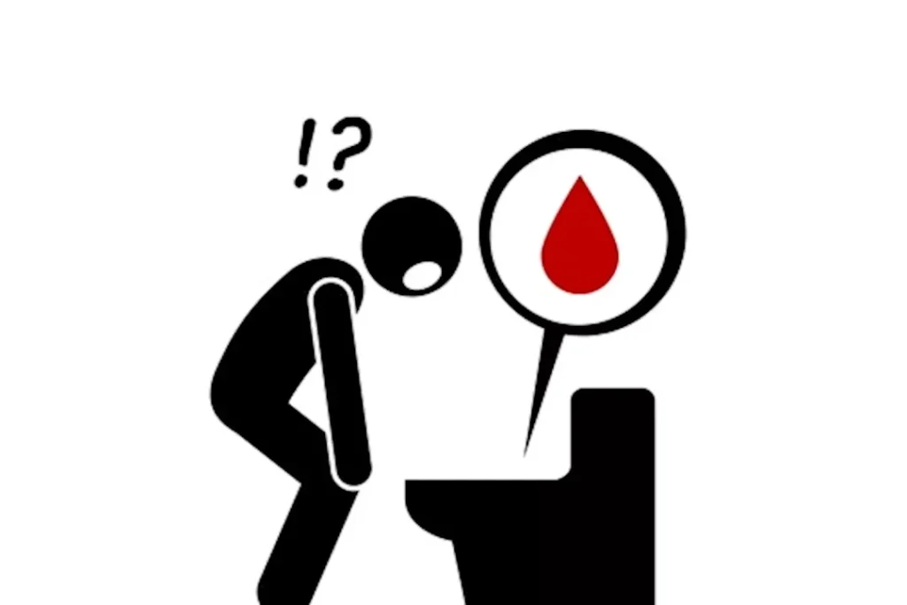 وجود مخاط دموي في البراز: هذه الأمراض قد تكون هي السبب