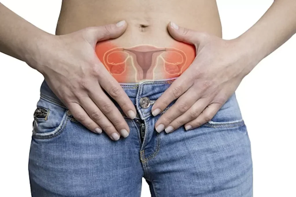 دراسة كورية: قلة الإنجاب ترفع خطر سرطان المبيض