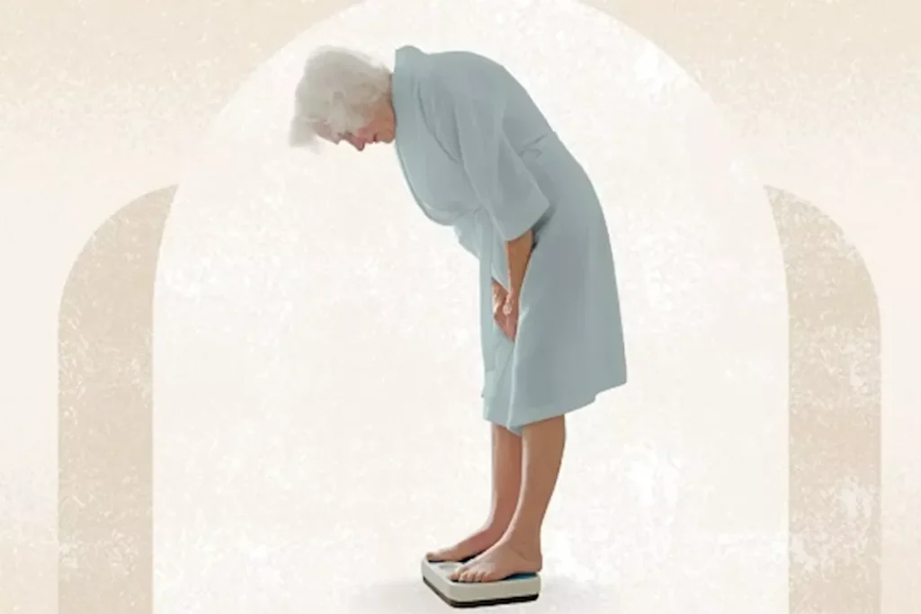 فقدان الوزن لمرضى الكلى: نصائح من طبيبة