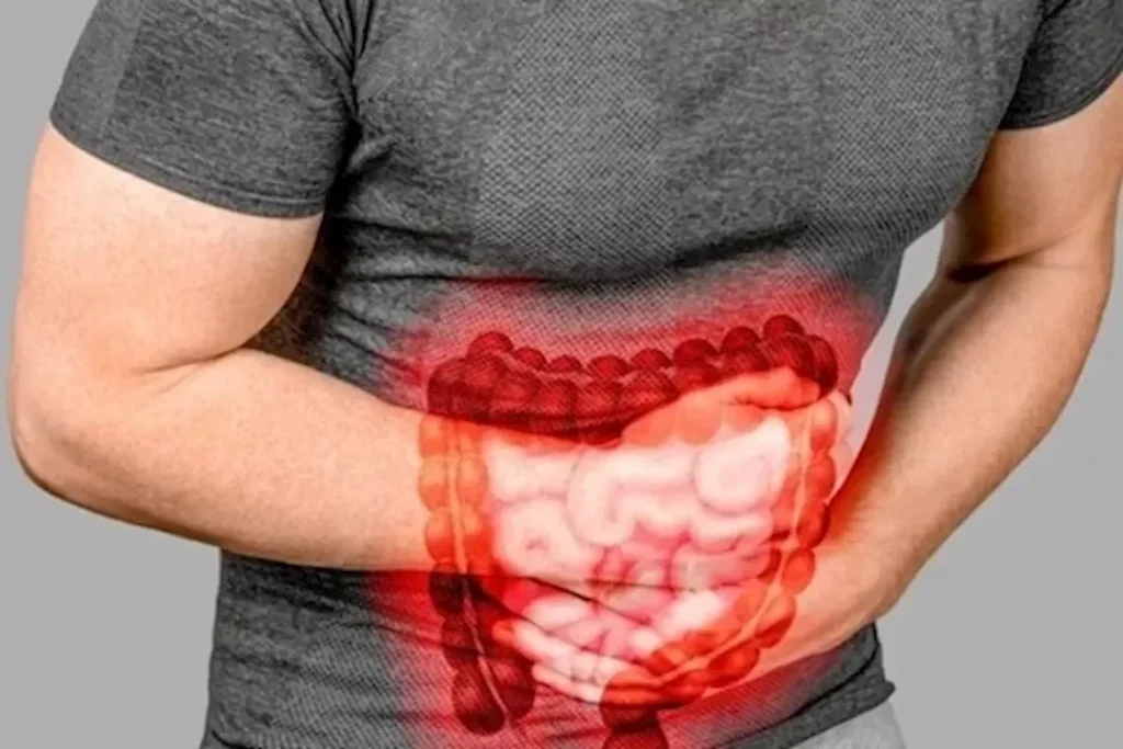 مرضى القولون في رمضان: طبيبة توصي بتناول القراصيا عند الإفطار