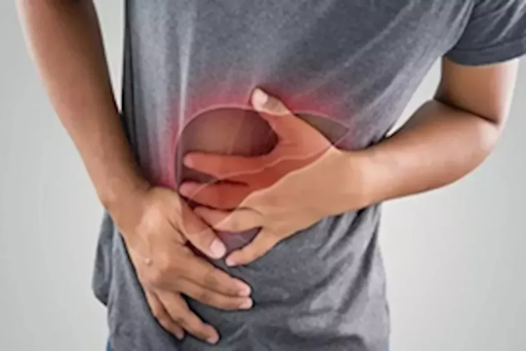الكبد الدهني: هل يسبب التليف؟ استشاري يوضح