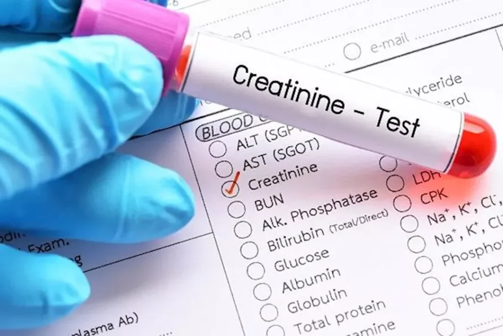 بدون أدوية – طبيب ينصحك بطرق لإعادة الكرياتينين لمستواه الطبيعي