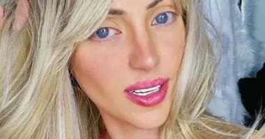 البرازيل تحسم الجدل حول وفاة انفلونسر ب27 عملية تجميل لتشبه باربى