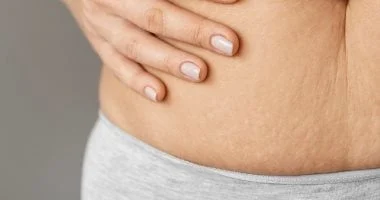 5 وصفات طبيعية سهلة للقضاء على السيلوليت