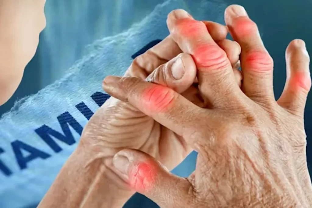 5 أعراض لنقص فيتامين B12 تظهر على أصابع اليدين